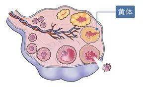 “黄体不健”是怎么回事