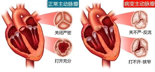 原以为要换个心脏零件,开胸之后我收到了意外的礼物 果壳病人