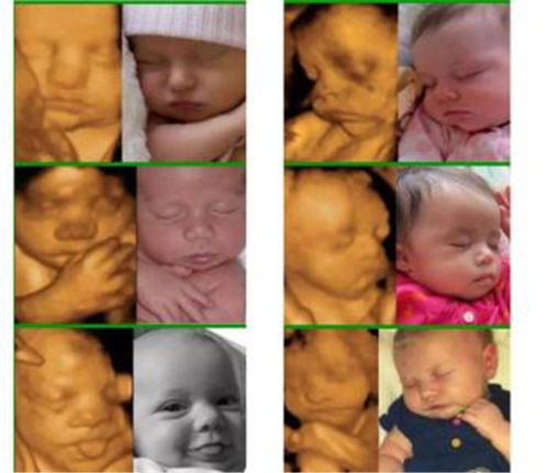 四维宝宝照(四维照片跟真婴儿对比一点也不像是怎么回事)