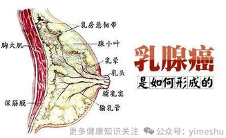 从乳房胀痛到乳腺癌,到底有多远