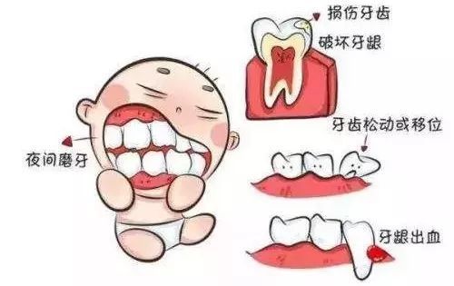 孩子磨牙,是肚子里有蛔虫吗 还可能是它们在捣蛋