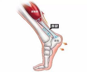 发烧腰疼怎么回事