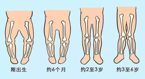 学步早的宝宝更聪明 最佳学步时间是这个月份,家长别被忽悠了