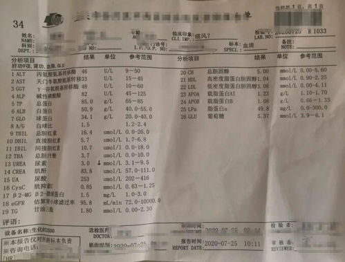 52岁男子尿酸值589到253,原来是坚持4习惯,医生都为他点赞了