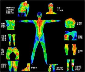 热成像检查的优势