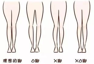 不同的腿型,怎么穿衣搭配才能显瘦并且好看,你属于哪种腿型呢 