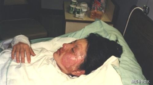 孙俪姨奶奶胡慧中首次晒视频 63岁皮肤白净无皱纹,曾被全身烧伤