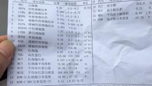 人到中年体检时,这6个指标若都正常,或说明身体还算健康