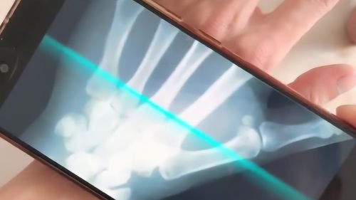手机扫描骨头是真的吗