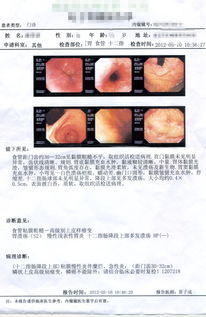 求助：我得了浸润性小叶癌，不知道（PT2N3M0，IIIc)是什么意思？