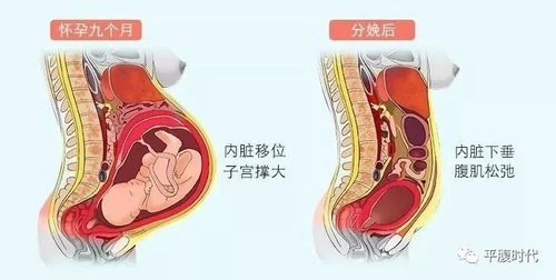 产后无忧 3招避免生完宝宝子宫掉出体外