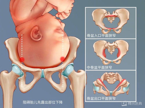 女人臀部大,好生养