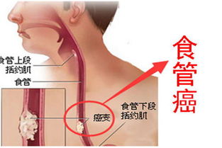 七种高发癌症离我们有多近