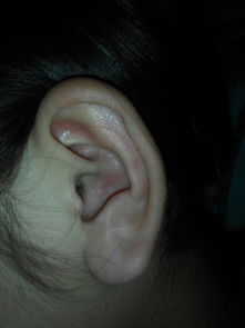 这个耳朵打耳洞会破坏运气吗 