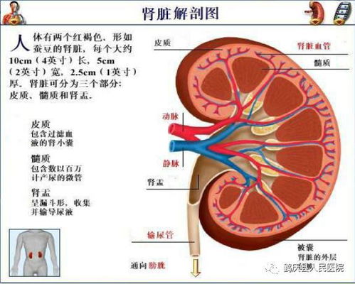 关于 肾结石