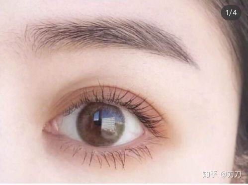 常见双眼皮的类型包括哪些,有哪几种 