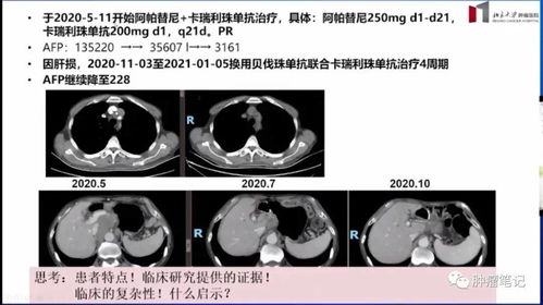 肿瘤大咖谈 沈琳教授实例讲解8大特殊类型胃癌的综合治疗