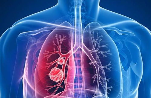 医生提醒 肺部有结节的人,这2种水果要多吃,或有助于结节消散
