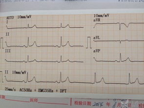 哪位老师帮分析下下周ST沪科的走势？