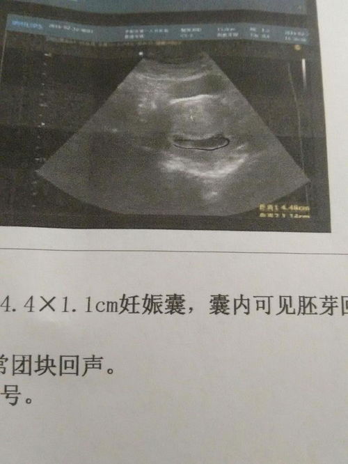 二胎宝宝性别早有暗示 一胎宝宝长得像爸爸,二胎生男孩