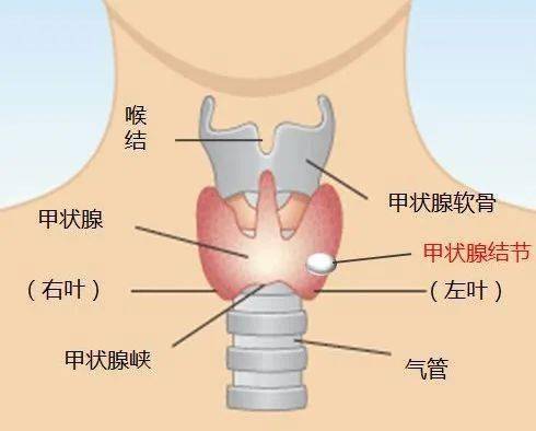 看到 甲状腺结节 莫急 专家 近九成都不用慌