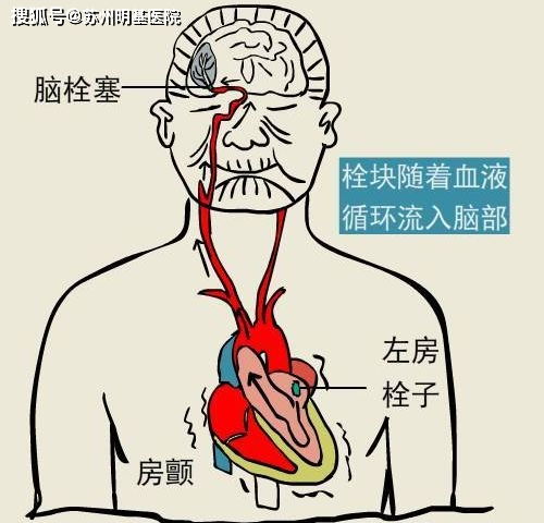 糟了 是心跳加速的感觉