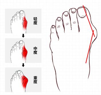 脚骨各个部位名称图 表情大全