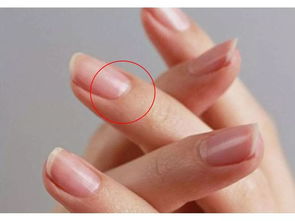 指甲半月痕代表什么