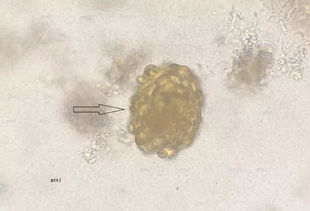 寄生虫形态 常见寄生虫卵 