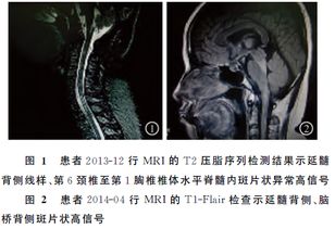 体感诱发电位 图片欣赏中心 急不急图文 Jpjww Com