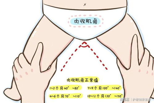 婴儿肌张力高的表现图片