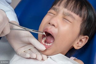 拔牙矫正牙齿有危险吗