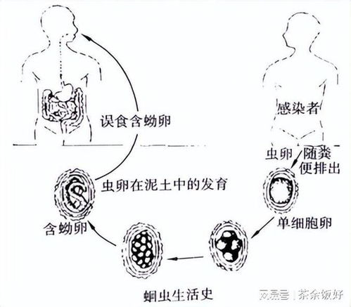 几十年前,人人肚子里几乎都有蛔虫,为何现在很少听说了