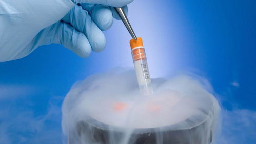 试管婴儿的这3种胚胎移植方式,你知道成功率最高的是哪种吗