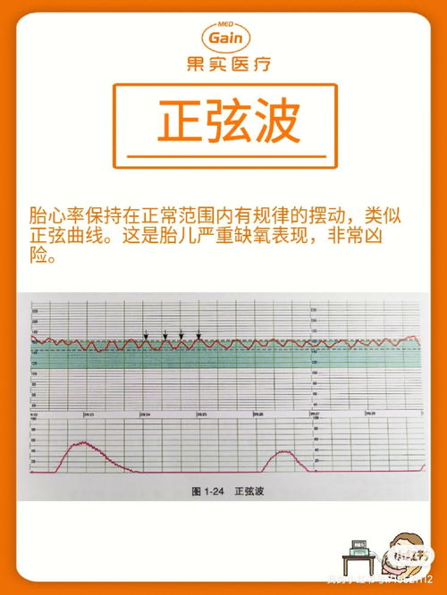 胎心率 什么是胎心率