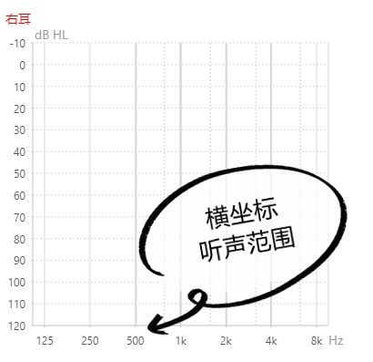 求人不如求己,带大家一分钟看懂听力图,做自己的听力管家