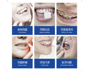 口腔健康遇危机 水牙线怎么用