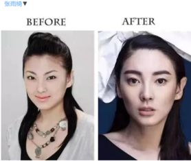 搜狐公众平台 脸型决定了你适合什么样的双眼皮 