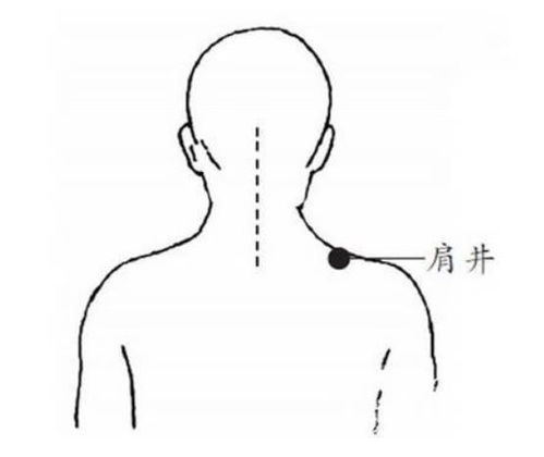 按摩可以治颈椎病吗 经常按摩这五大穴位,可以缓解颈椎病