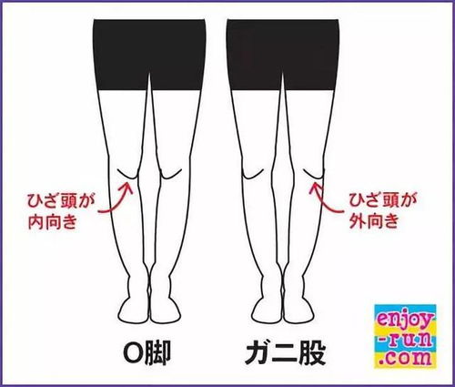 文明看腿 为何日本女生 罗圈腿 居多