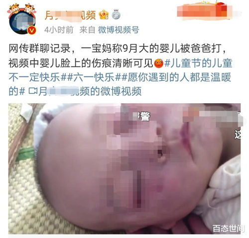 江西一名宝妈自曝9个月大幼儿遭亲生父亲虐打,两个脸颊伤痕累累