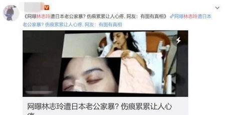 46岁林志玲因无法生育遭日本老公家暴 女神七夕当天仍狂撒狗粮