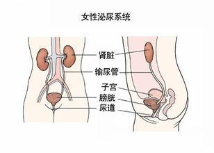 警惕孕期尿路感染会导致流产