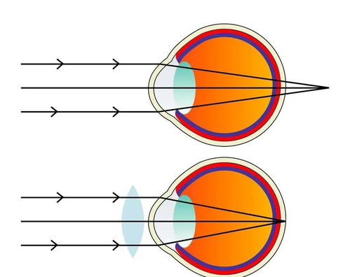 远视和近视哪个危害大(远视和近视哪个危害大些)