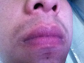 每次刮完胡子嘴唇上面还是有一条很深很黑的胡子痕迹,怎么办啊 