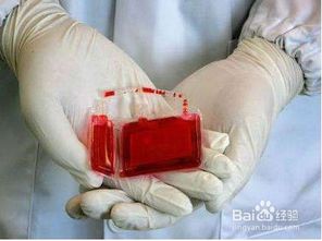 保存脐带血 如何保存脐带血