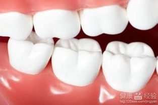 成人牙齿矫正会对脸型有影响吗