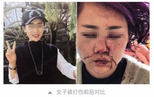 丽江女子被暴打的嫌犯抓到了吗 