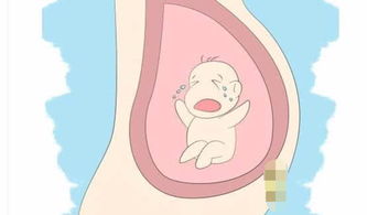 怀孕后,这几个习惯孕妇要不要改 医生 会导致羊水变差 