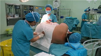 超重孕妇累瘫医生 她刚一踩上去指针爆表 